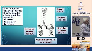 Corps étrangers laryngés trachéaux et bronchiques chezlenfant Pr Abderrahmane Abid  Casablanca [upl. by Gearard]