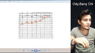 Odyoloji Hakkında Weber Test Mantığı ve Kemik Yolu İletimi [upl. by Stanislaus774]