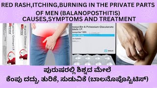 BALANOPOSTHITISಪುರುಷರಿಗೆ ಗುಪ್ತಾಂಗದಲ್ಲಿ ಕಾಡುವ ತುರಿಕೆPAINRASHES AND BURNING CREAMS AND TABLETS [upl. by Etteiluj]