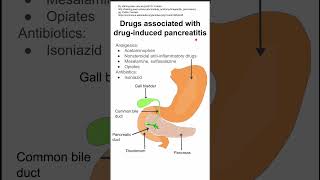 Drugs associated with druginduced pancreatitis [upl. by Belva]