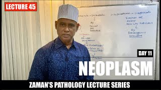 General Pathology Lecture 45  Neoplasm  Day 11 [upl. by Iasi416]