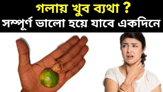 গলায় ব্যথা হলে কি করা উচিতgola betha hole ki korboHome Remedies for Sore Throatpts [upl. by Yeclek105]