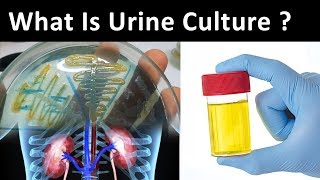 What is Urine Culture [upl. by Adnomal]