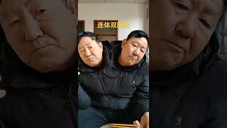 Daily life of conjoined twins This video is not real life entertainment [upl. by Sirred]