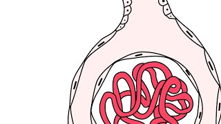 Glomerulonefritis rápidamente progresiva [upl. by Daph]