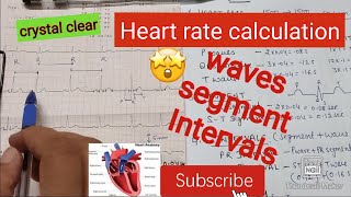 ECG calculation of HR waves intervals ampsegment [upl. by Sunda]