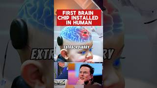 First Human gets Brain Chip Implant🧠 ytshorts shorts news breakingnews elonmusk technews [upl. by Feerahs]