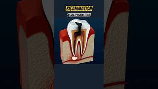 tooth cavity remove 3D animation video cavite teeth 3d animation like shorts humananatomy [upl. by Lalad]