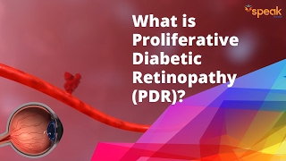 What is Proliferative Diabetic Retinopathy PDR [upl. by Aikel21]