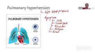 Auricles Exam Mastery Physiology Live Class about Respiratory System 4 by Dr Aanchal [upl. by Branen]