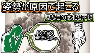 【岡山の筋膜整体】姿勢の悪さの原因は下半身周りの筋肉の硬さから発生しています！対策と予防法を解説！ [upl. by Nosde]