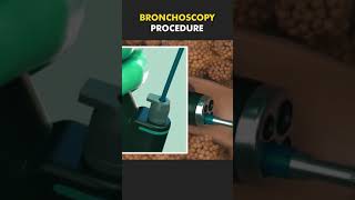 bronchoscopy procedure bscnursing ytshorts medicalstudent doctor lungs nursing [upl. by Whyte]