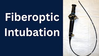 Fiberoptic Intubation  Difficult Airway Management [upl. by Concepcion]