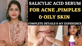 Salicylic Acid Serum 2॥ Really Effective or not ॥ Salicylic acid benefits for acne and pimples ॥ [upl. by Nitreb]