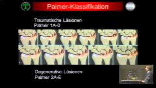 Läsionen des TFCKomplexes am Handgelenk [upl. by Jacob140]