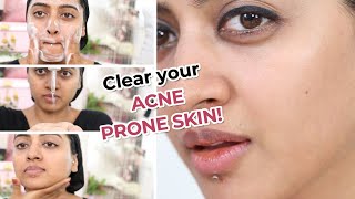 Salicylic Acid Acne Prone Skin Care Routine [upl. by Neemsay194]