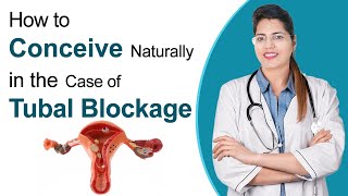 Best Way to Get Pregnant with Blocked Fallopian Tube  How to Unblock Fallopian Tubes  Dr Chanchal [upl. by Poppo403]