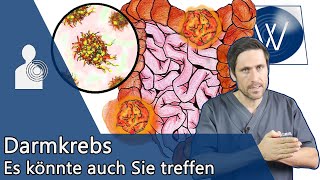 Darmkrebs Was wir dagegen tun können amp worauf wir achten müssen – Ursachen Symptome amp Therapie [upl. by Zola]