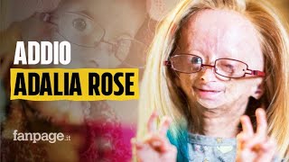 Morta Adalia Rose la youtuber 15enne che raccontava la sua vita con la progeria [upl. by Ankney]