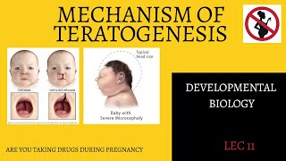 Mechanism of TeratogenesisAbnormal DevelopmentBSMS [upl. by Rillis]