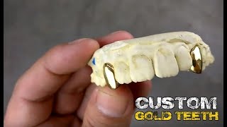 Custom Gold Teeth Grillz Single Cap Real Grills Canine Set  BlingCartelCom [upl. by Raseda]