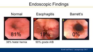 Practical Approach to Management of Extraesophageal GERD [upl. by Harte]