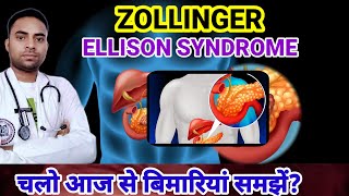 Whats Zollinger Ellison Syndrome ZES DISEASE  SYMPTOMS OF ZES  DISEASES [upl. by Aratihc]