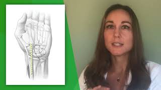 Top 3 Things Patients Wish they Knew Before Thumb Arthritis Surgery by Debra Anne Bourne MD [upl. by Nairehs]