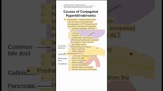 Causes of Conjugated Hyperbilirubinemia [upl. by Redle]