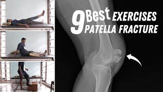 9 Best Patella Fracture Recovery Exercises after broken kneecap surgery [upl. by Arjan]