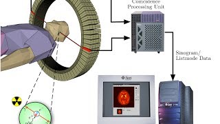 how does PET Scan Works [upl. by Vish]