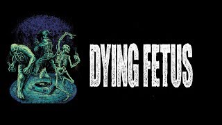 DYING FETUS Live Paris 09 11 2017 [upl. by Aciretal]