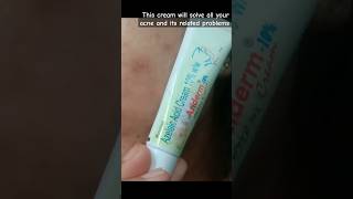 Aziderm 10 cream review how to use azelaic acids cream 10 ww shorts youtubeshorts [upl. by Garreth]