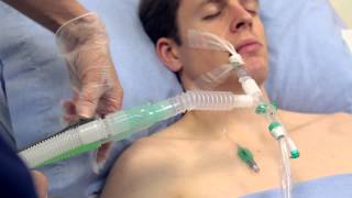 Using Intersurgicals TrachSeal™ closed suction systems [upl. by Ennirak]