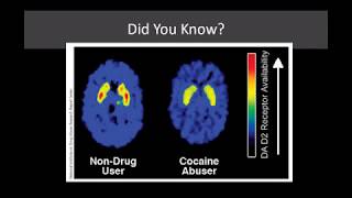 Lecture 12 The Neurobiology of Addiction From Use to Addiction [upl. by Cherilyn]