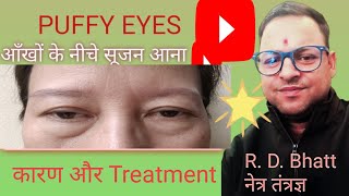 Puffy eye क्याहोता he What is puffy eyes आँखों ke नीचे सूजन ka kaaran or Treatment [upl. by Aruam]