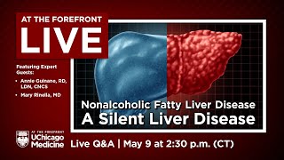 Nonalcoholic Fatty Liver Disease  A Silent Liver Disease  Expert QampA [upl. by Arutak140]