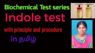 Indole test Biochemical test series Tamil microbiologyintamil2811 [upl. by Bradney801]