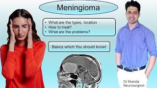 Meningioma Symptoms Treatment Most common benign brain tumor Things U should know By Dr Skanda [upl. by Frants]