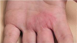 Dermatology Treatments  How to Diagnose Skin Rashes [upl. by Bentley]