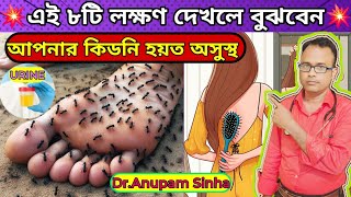 💥এই ৮টি লক্ষণ দেখলেই বুঝবেন আপনার কিডনি খারাপ হতে শুরু হয়েছে। Early Signs Of Kidney Disease [upl. by Namrej442]