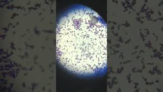 Gram positive cocciEnterococcus microscopy mltstudent staining likeforlikes shorts [upl. by Herrick]