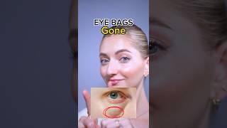 eye bags gone🔥 eyebags faceexercises faceyoga facefitness facemassage [upl. by Nazus]