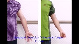 Gunstock deformity cubitus varusvalgus surgery  GangnamGN Champion Orthopedic Surgery Hospital [upl. by Midis]