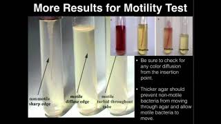 Microbiology Motility Test [upl. by Franzen]