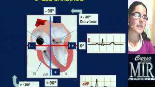 Cómo interpretar un ECG repaso [upl. by Rohpotsirhc]