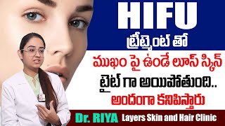 HIFU Treatment for Skin Tightening  Skin Treatment  Layers Skin and Hair Clinic  SumanTv [upl. by Veno]