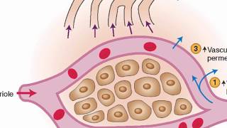 Mechanisms of edema development [upl. by Reggis239]