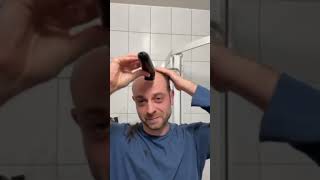 Balding Man Shocked By EPIC Transformation [upl. by Yemrej611]