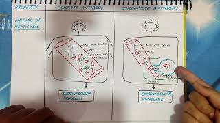 Coombs test explained  Antiglobulin Test  AHG reagent  Principle  Signficance [upl. by Ema946]